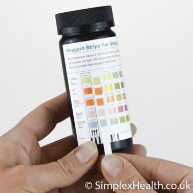 Urinalysis Multi-parameter Test Strips