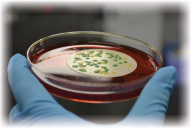 Bacteria: Coliform/E.coli, Enterococci (Lab Test)